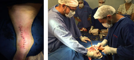 A cirurgia de “Clara” e a equipe de veterinários realizando o trabalho.